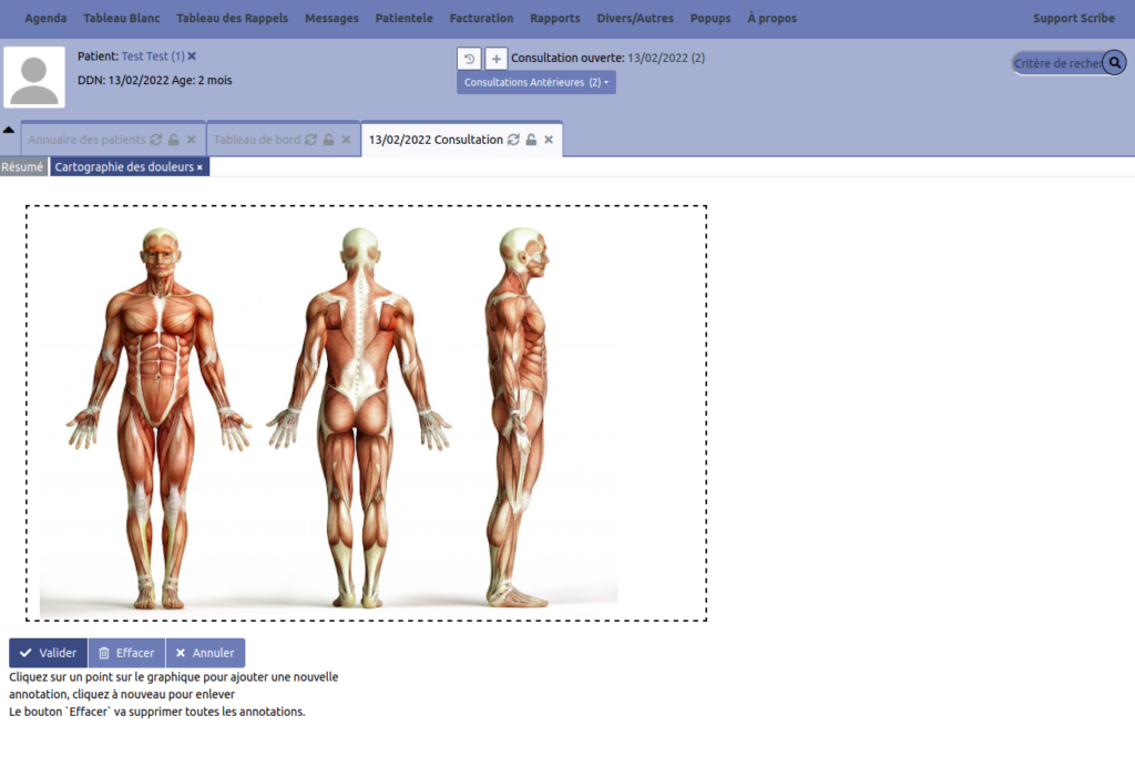logiciel osteopathe - cartographie des douleurs
